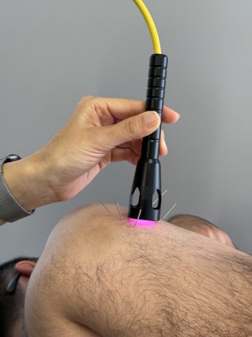 فیزیوتراپی در کیش لیزر پرتوان